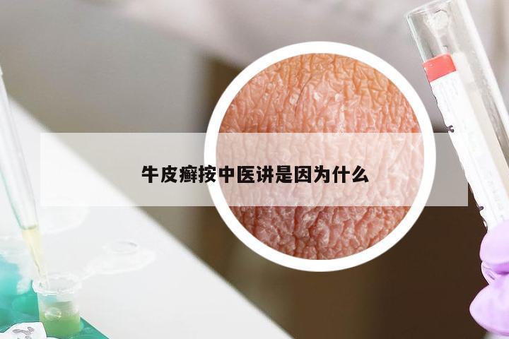 牛皮癣按中医讲是因为什么