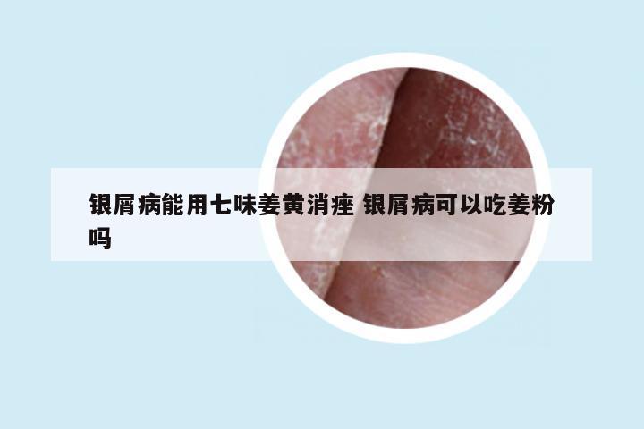 银屑病能用七味姜黄消痤 银屑病可以吃姜粉吗