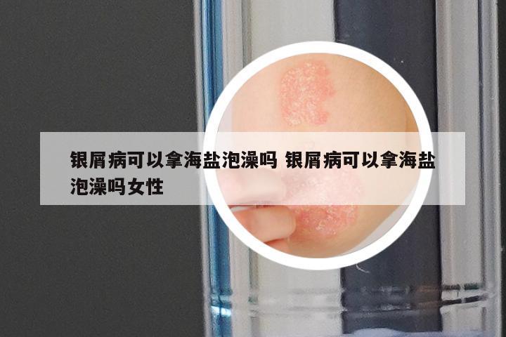 银屑病可以拿海盐泡澡吗 银屑病可以拿海盐泡澡吗女性