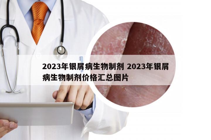 2023年银屑病生物制剂 2023年银屑病生物制剂价格汇总图片