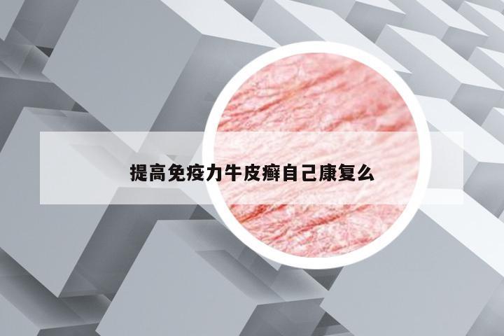 提高免疫力牛皮癣自己康复么