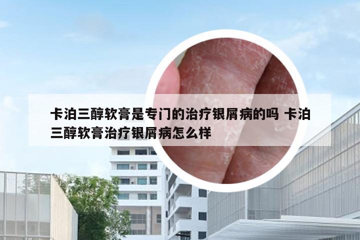 卡泊三醇软膏是专门的治疗银屑病的吗 卡泊三醇软膏治疗银屑病怎么样