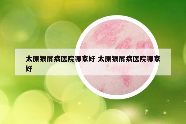 太原银屑病医院哪家好 太原银屑病医院哪家好