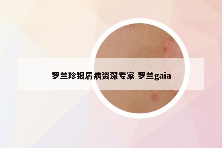 罗兰珍银屑病资深专家 罗兰gaia