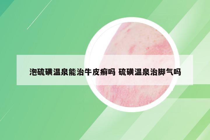 泡硫磺温泉能治牛皮癣吗 硫磺温泉治脚气吗