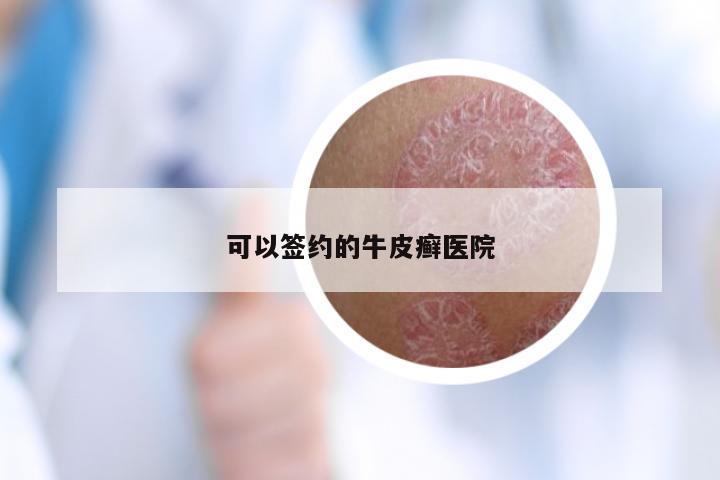 可以签约的牛皮癣医院