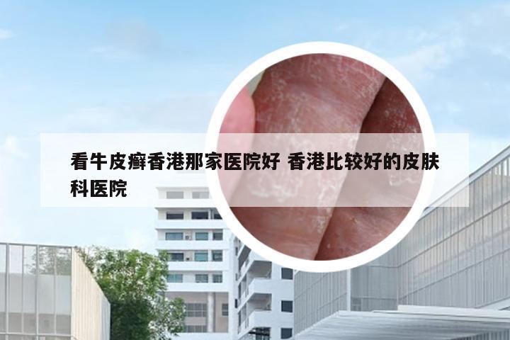 看牛皮癣香港那家医院好 香港比较好的皮肤科医院