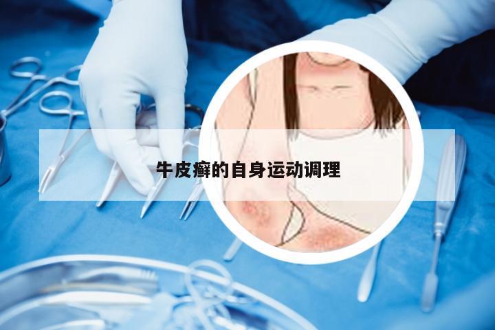 牛皮癣的自身运动调理