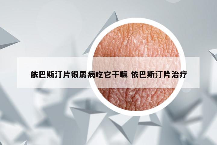 依巴斯汀片银屑病吃它干嘛 依巴斯汀片治疗