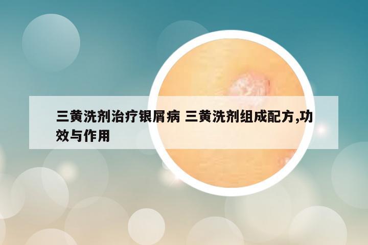 三黄洗剂治疗银屑病 三黄洗剂组成配方,功效与作用