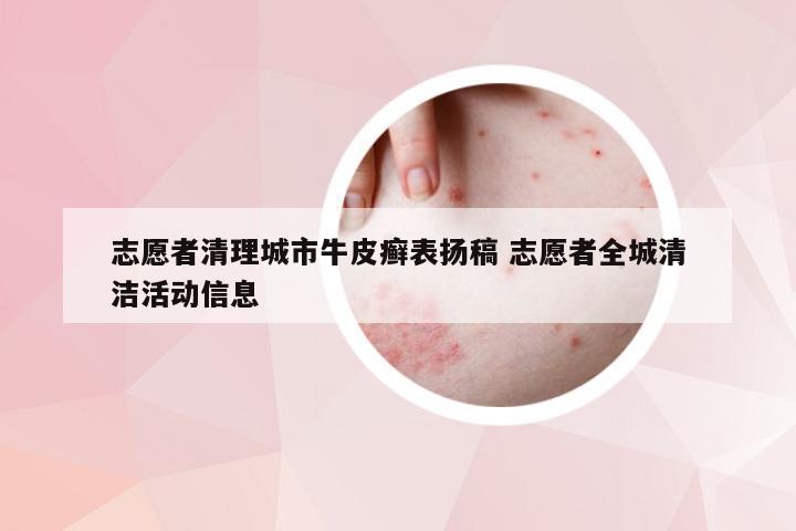 志愿者清理城市牛皮癣表扬稿 志愿者全城清洁活动信息