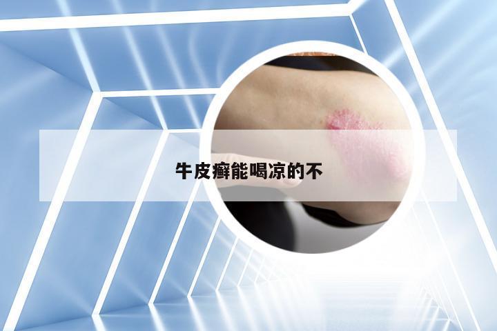 牛皮癣能喝凉的不
