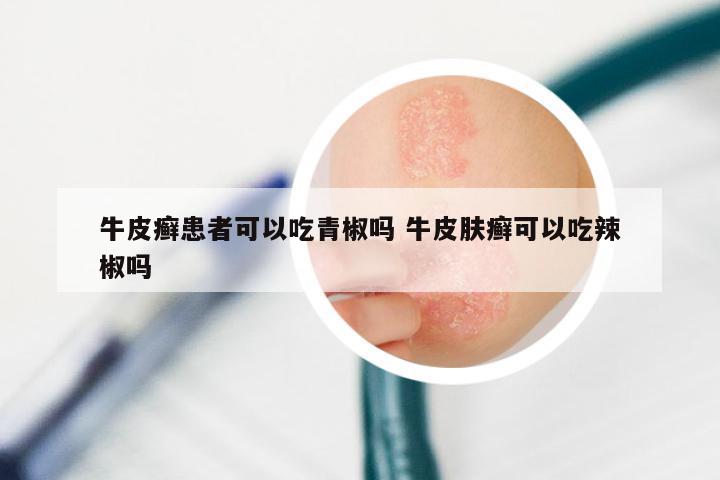 牛皮癣患者可以吃青椒吗 牛皮肤癣可以吃辣椒吗