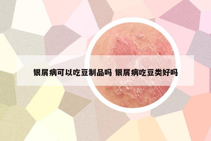 银屑病可以吃豆制品吗 银屑病吃豆类好吗