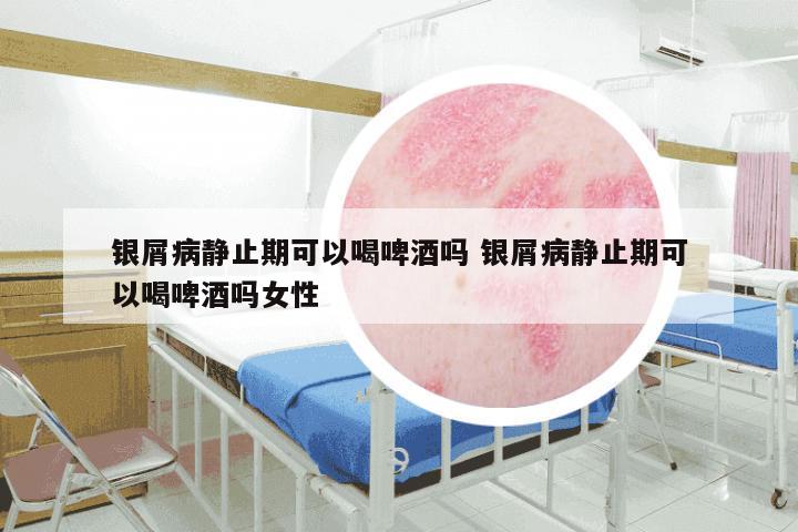 银屑病静止期可以喝啤酒吗 银屑病静止期可以喝啤酒吗女性