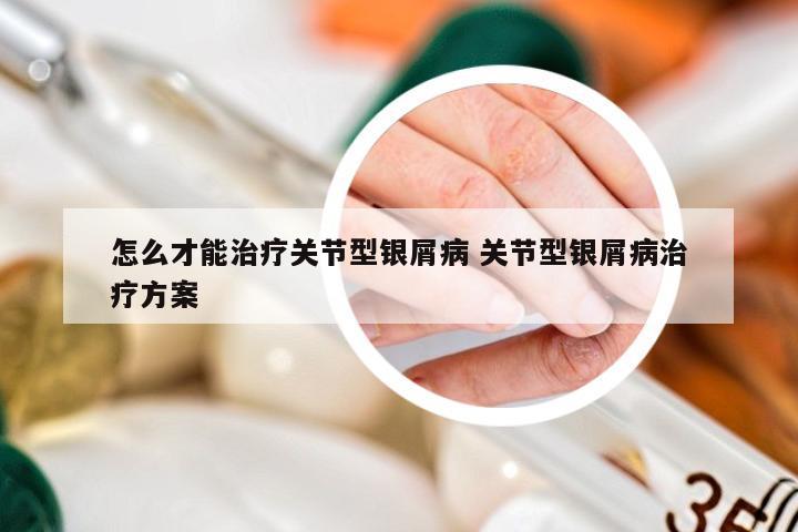 怎么才能治疗关节型银屑病 关节型银屑病治疗方案