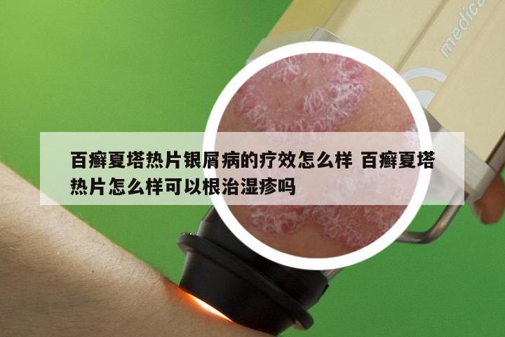 百癣夏塔热片银屑病的疗效怎么样 百癣夏塔热片怎么样可以根治湿疹吗
