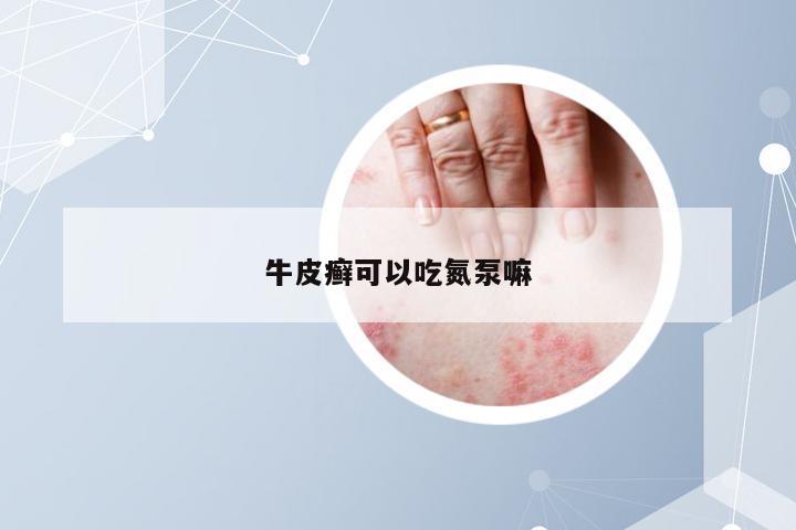 牛皮癣可以吃氮泵嘛