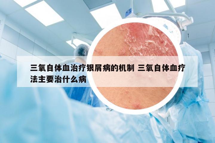 三氧自体血治疗银屑病的机制 三氧自体血疗法主要治什么病