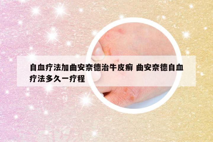 自血疗法加曲安奈德治牛皮癣 曲安奈德自血疗法多久一疗程