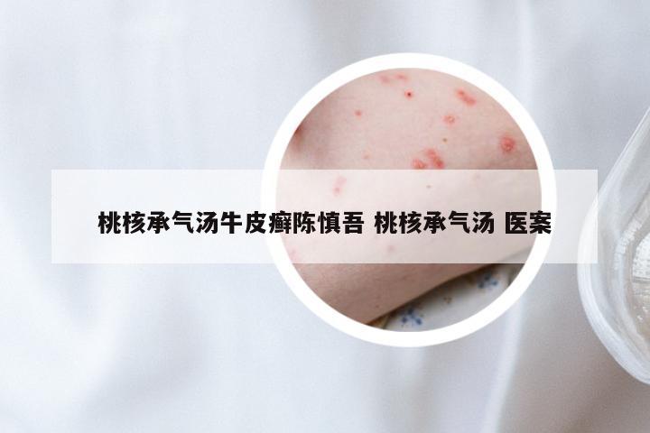 桃核承气汤牛皮癣陈慎吾 桃核承气汤 医案