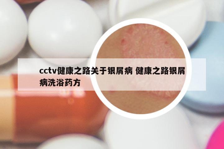 cctv健康之路关于银屑病 健康之路银屑病洗浴药方