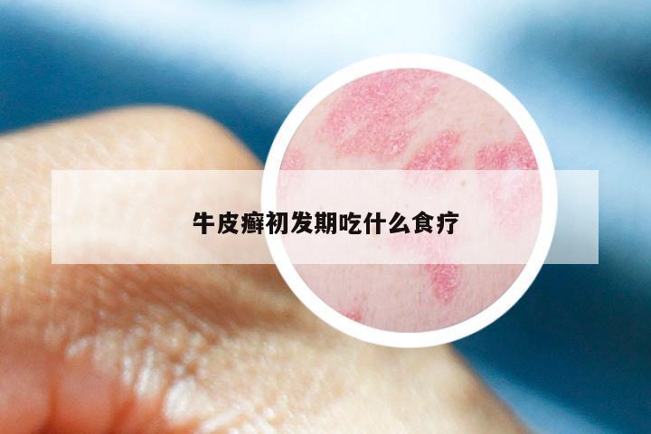 牛皮癣初发期吃什么食疗