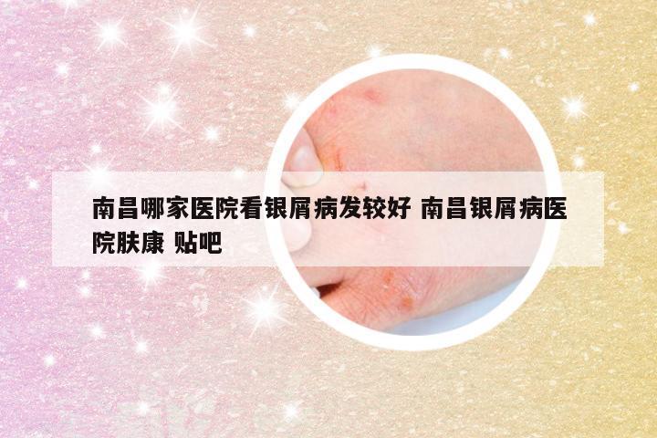 南昌哪家医院看银屑病发较好 南昌银屑病医院肤康 贴吧
