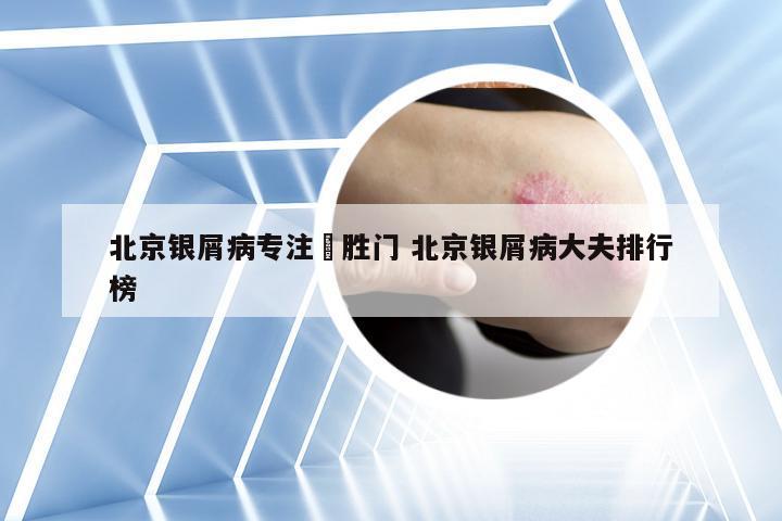 北京银屑病专注徳胜门 北京银屑病大夫排行榜