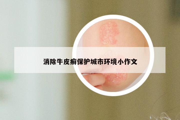 消除牛皮癣保护城市环境小作文