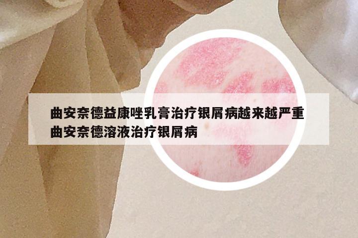 曲安奈德益康唑乳膏治疗银屑病越来越严重 曲安奈德溶液治疗银屑病