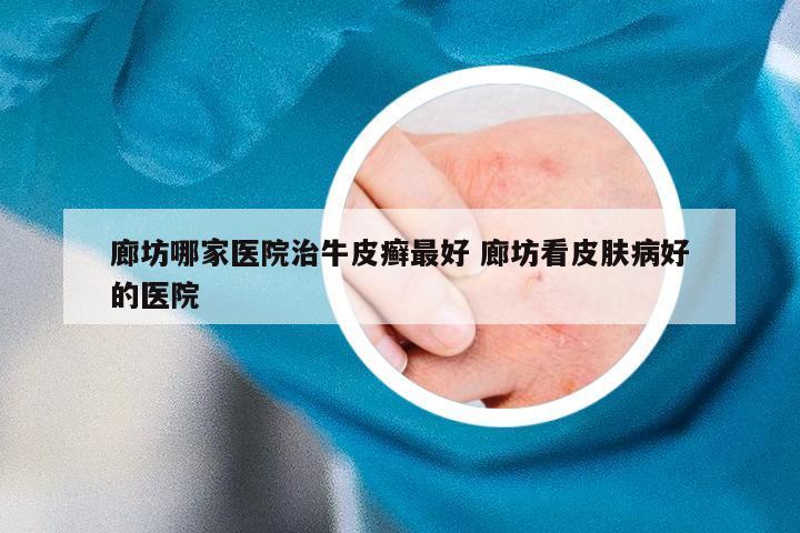廊坊哪家医院治牛皮癣最好 廊坊看皮肤病好的医院