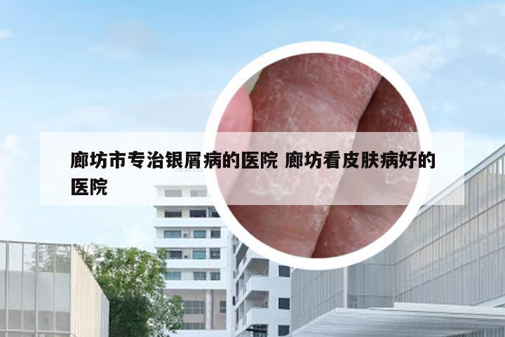 廊坊市专治银屑病的医院 廊坊看皮肤病好的医院