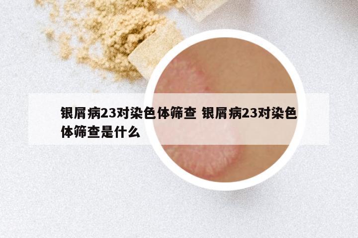 银屑病23对染色体筛查 银屑病23对染色体筛查是什么