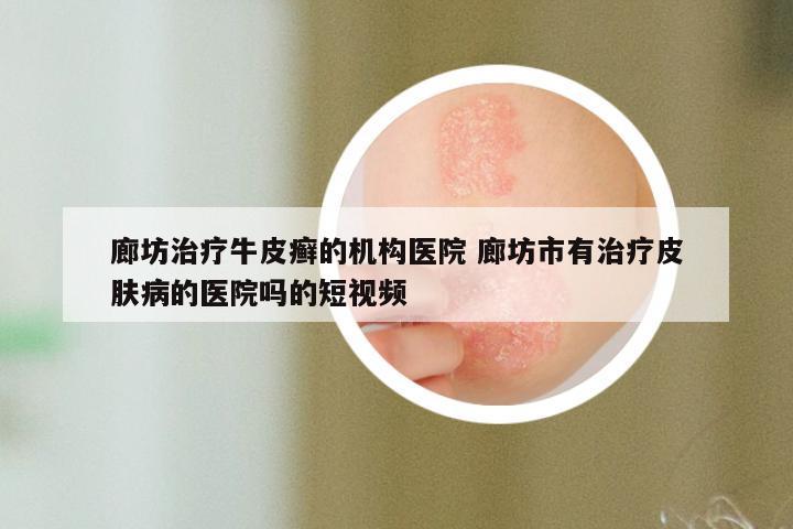 廊坊治疗牛皮癣的机构医院 廊坊市有治疗皮肤病的医院吗的短视频