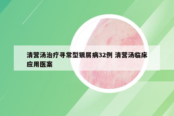 清营汤治疗寻常型银屑病32例 清营汤临床应用医案
