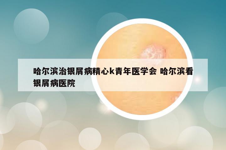 哈尔滨治银屑病精心k青年医学会 哈尔滨看银屑病医院