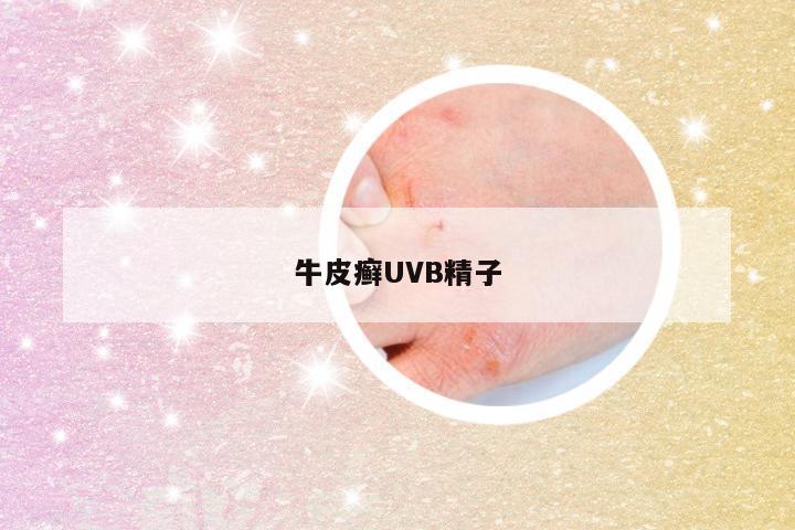 牛皮癣UVB精子