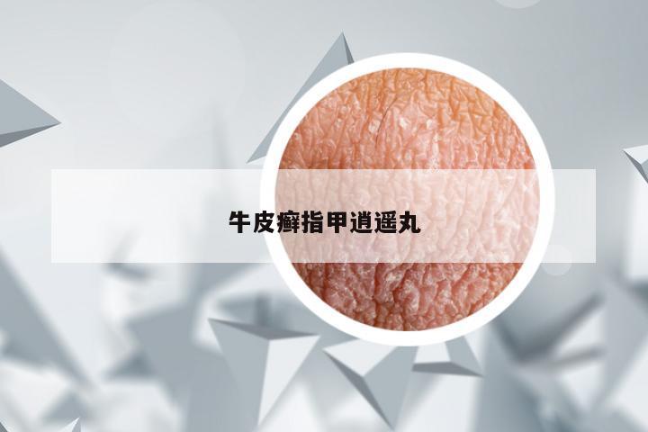 牛皮癣指甲逍遥丸