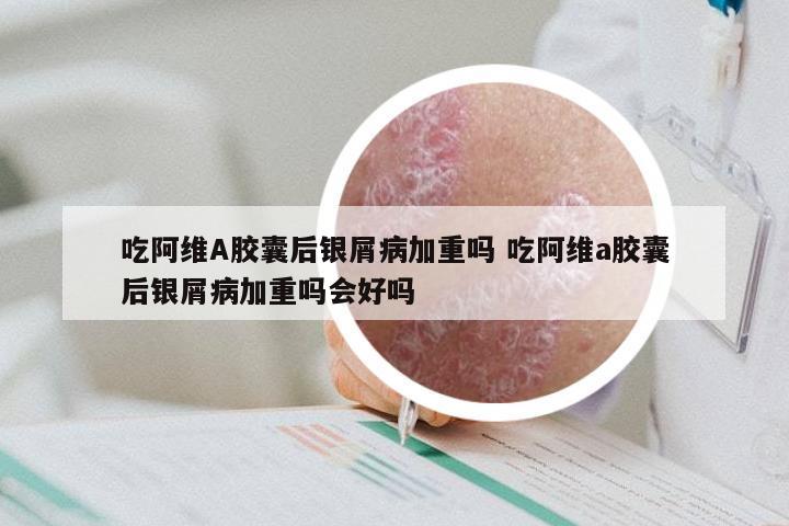 吃阿维A胶囊后银屑病加重吗 吃阿维a胶囊后银屑病加重吗会好吗