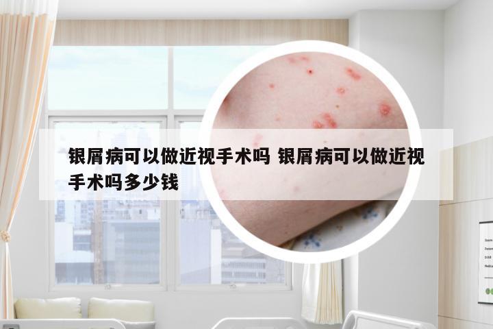 银屑病可以做近视手术吗 银屑病可以做近视手术吗多少钱