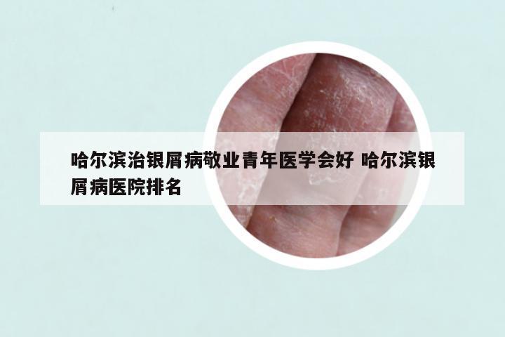 哈尔滨治银屑病敬业青年医学会好 哈尔滨银屑病医院排名