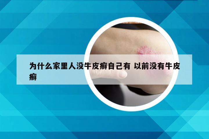 为什么家里人没牛皮癣自己有 以前没有牛皮癣