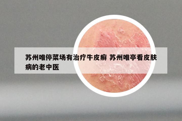 苏州唯停菜场有治疗牛皮癣 苏州唯亭看皮肤病的老中医