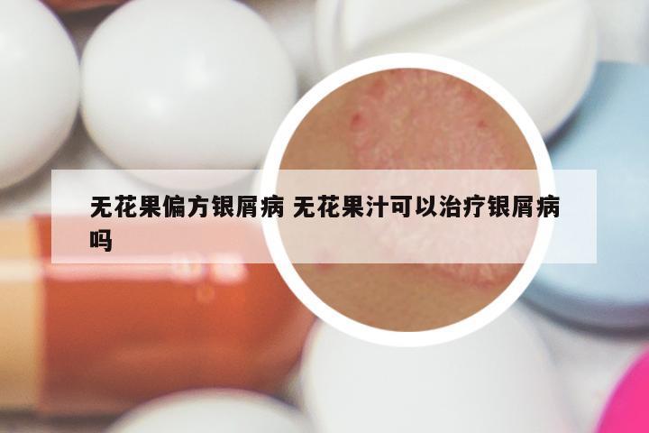 无花果偏方银屑病 无花果汁可以治疗银屑病吗