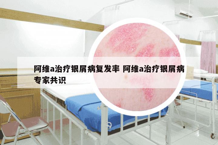 阿维a治疗银屑病复发率 阿维a治疗银屑病专家共识