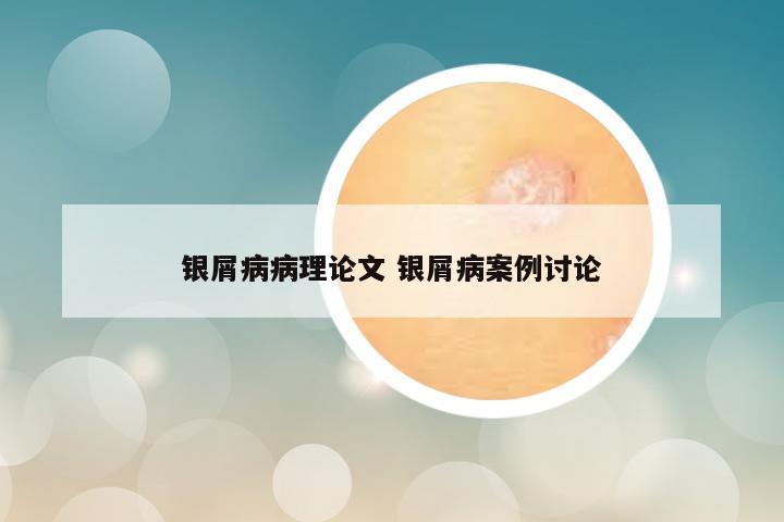 银屑病病理论文 银屑病案例讨论