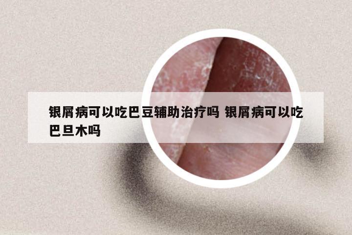 银屑病可以吃巴豆辅助治疗吗 银屑病可以吃巴旦木吗