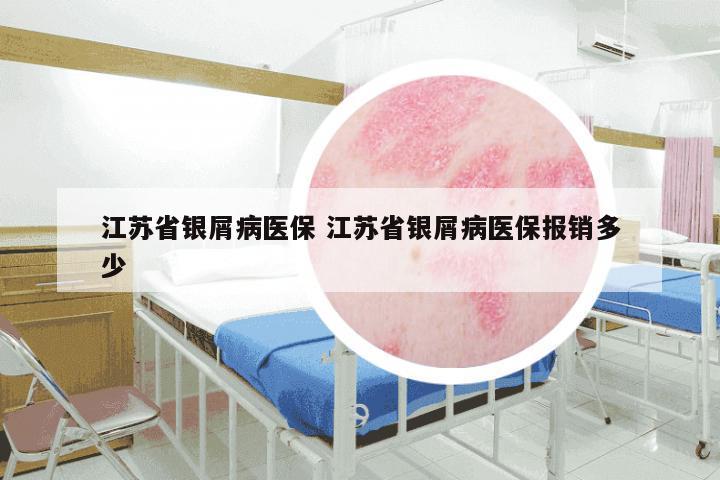 江苏省银屑病医保 江苏省银屑病医保报销多少