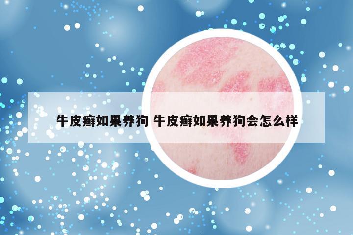 牛皮癣如果养狗 牛皮癣如果养狗会怎么样